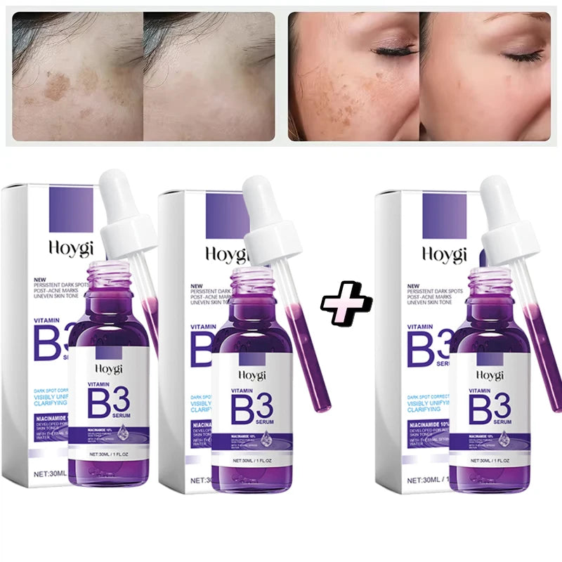 Hoygi Niacinamide Facial Serum Vitamin B3 Wrinkles Pigment Dark Spot Removal Correcting Glow Serum Face Whitening Moisturizer