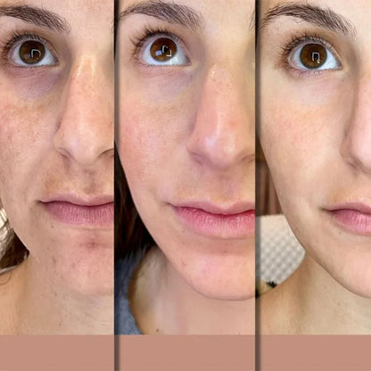 Hoygi Niacinamide Facial Serum Vitamin B3 Wrinkles Pigment Dark Spot Removal Correcting Glow Serum Face Whitening Moisturizer