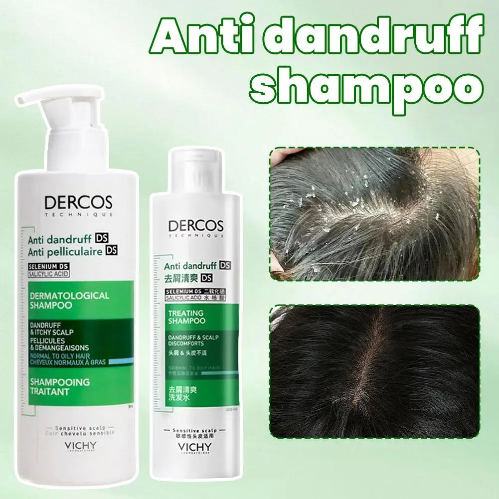 Oil Control Shampoo Fluffy Shampooing Traitant Soothing Damaged Hair Treating Shampoo Refreshing Hair Care