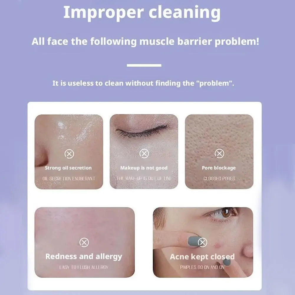 Perilla Essence Facial Cleanser Deep Cleaning Gentle Oil Control Refreshing Acne Removal Shrink Pores Cleanser Face Skin Care