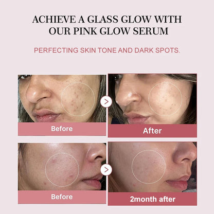 Complex Peptide Acne Serum PDRN Collagen Shrink Pores Fade Melanin Smooth Brightening Skin Korean Skincare Products