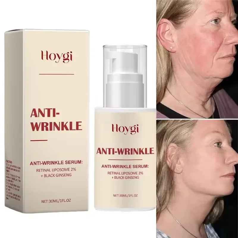 Seoul 1988 2% Retinal Anti Aging Wrinkle Serum Ginseng Facial Essence Firming Pores Brightening Face Moisturizer Korean Skincare