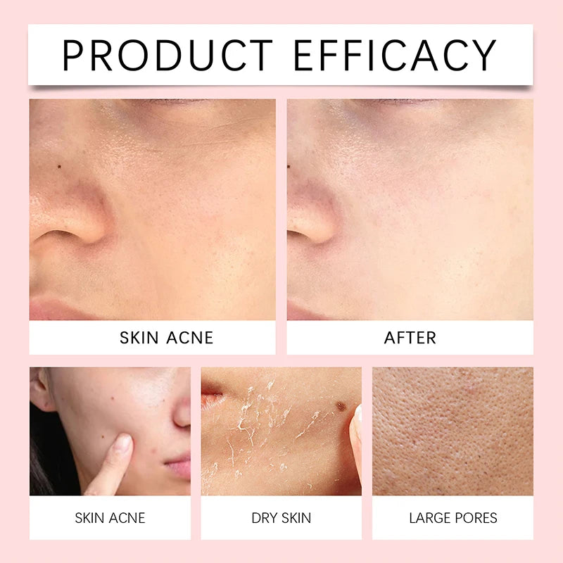 1/2/3/5 Pcs Centella Pore Minimizing Deep Cleansing Foam,Facial Skin Cleanser Moisturizing Soothing,Remove Pore-Clogging Debris