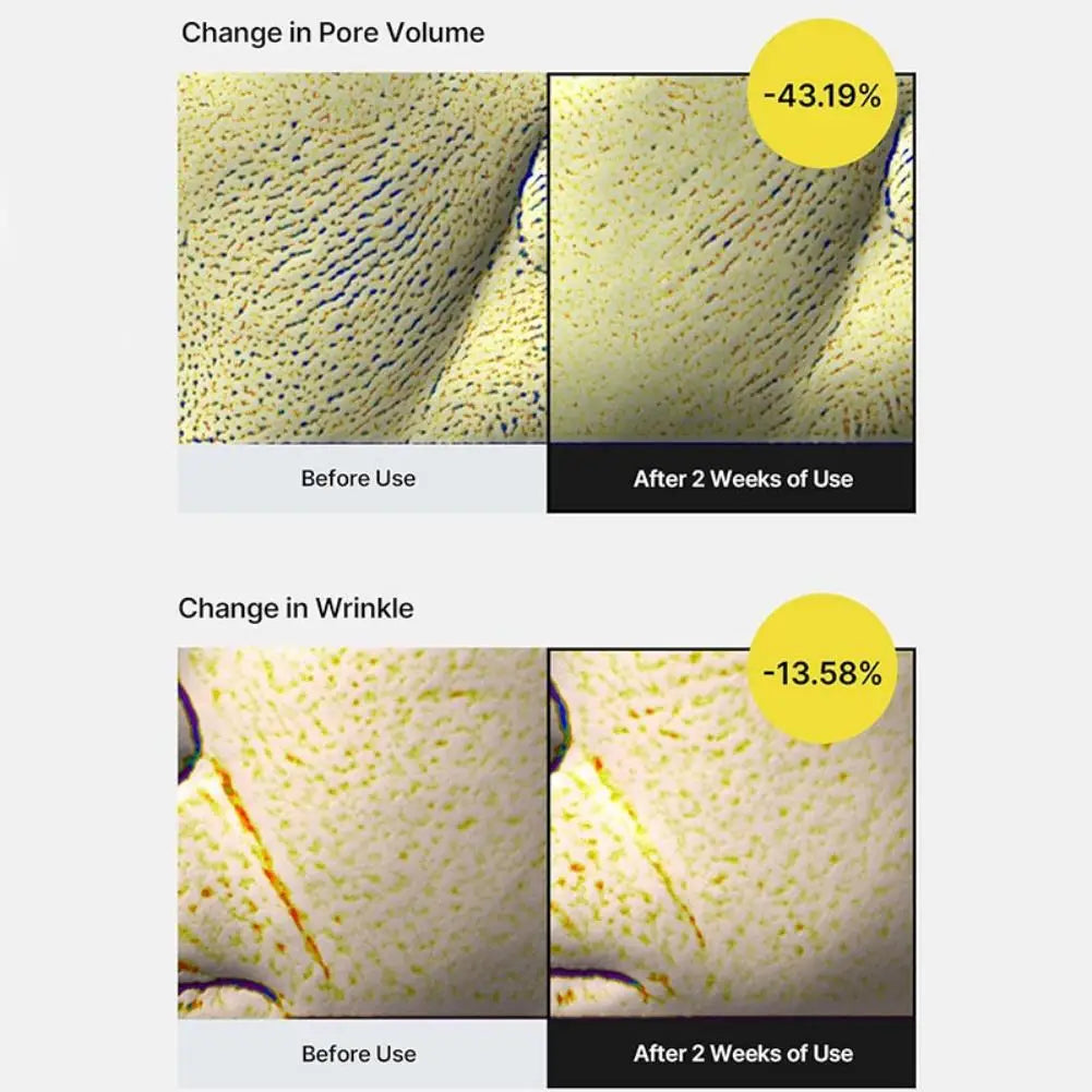 Korean Vita A Retinol Shot Tightening Booster Firming Enhancer Moisturizing Pore Shrinking Dark Circles Serum Skin Care