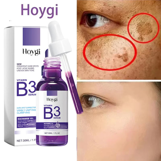 Hoygi Niacinamide Facial Serum Vitamin B3 Wrinkles Pigment Dark Spot Removal Correcting Glow Serum Face Whitening Moisturizer