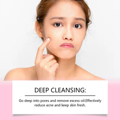 Hanchobit Kojic Acid Dark Spot Remover Soap Remove Acne Refreshing Lighten Skin Brightening Turmeric Facial Cleansing Soap 100g