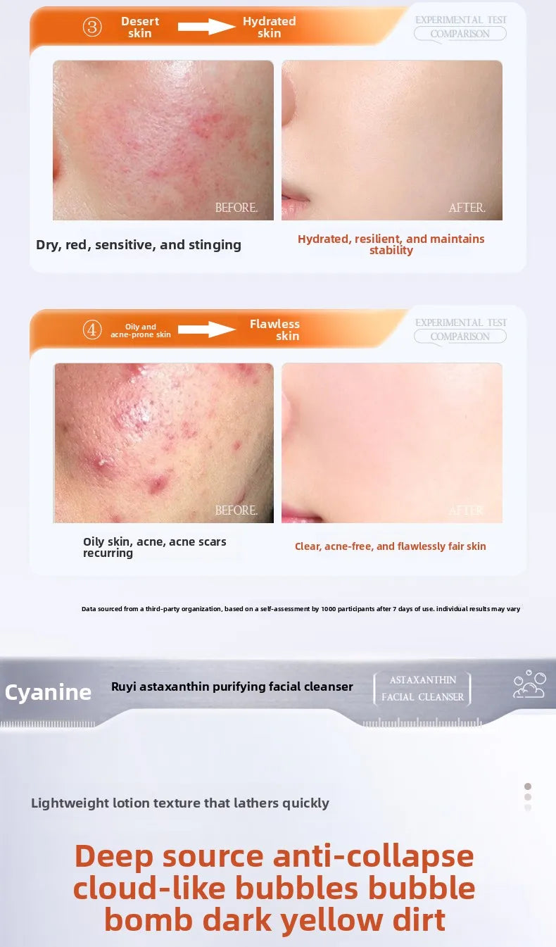 Astaxanthin facial cleanser whitening, oil control, deep cleansing, acne removal, fading marks and pore shrinking facial cleanse