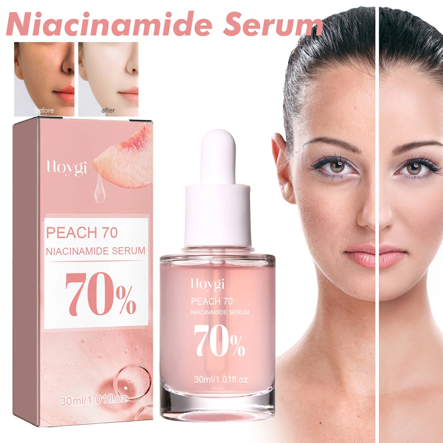 Niacinamide Facial Serum Improves Skin tone,Fades Dark Spots and Acne Improves Enlarged Pores Natural Anti-Aging Face Essence