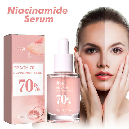 Niacinamide Facial Serum Improves Skin tone,Fades Dark Spots and Acne Improves Enlarged Pores Natural Anti-Aging Face Essence