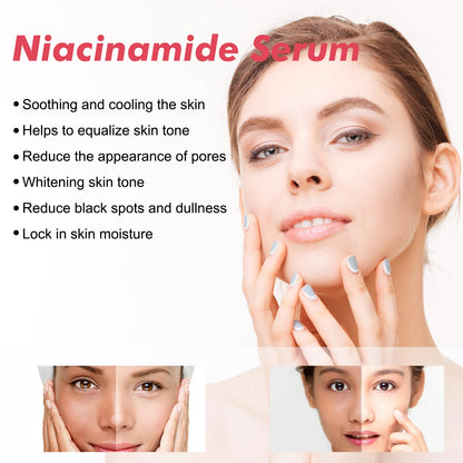 Niacinamide Facial Serum Improves Skin tone,Fades Dark Spots and Acne Improves Enlarged Pores Natural Anti-Aging Face Essence