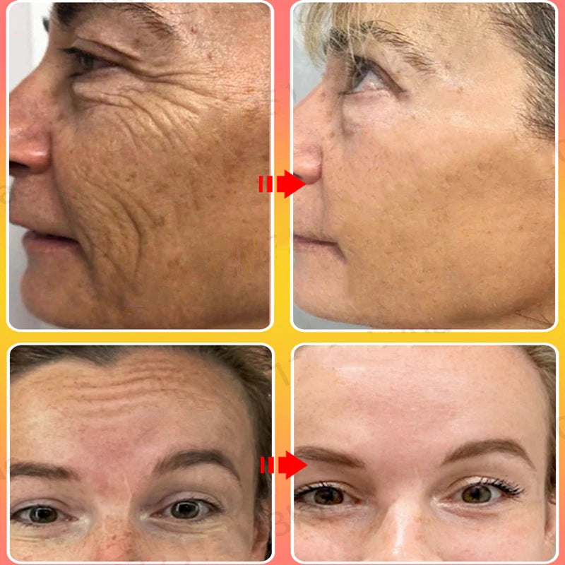 2Pcs Sakura Whitening Face Cream Wrinkle Remover Serum Anti-Aging Fade Fine Lines Lift Firming Essence Brighten Smooth Skin Care