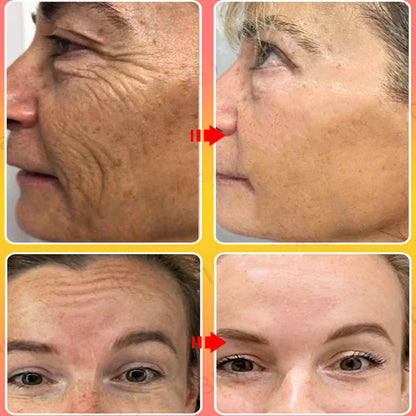 2Pcs Sakura Whitening Face Cream Wrinkle Remover Serum Anti-Aging Fade Fine Lines Lift Firming Essence Brighten Smooth Skin Care