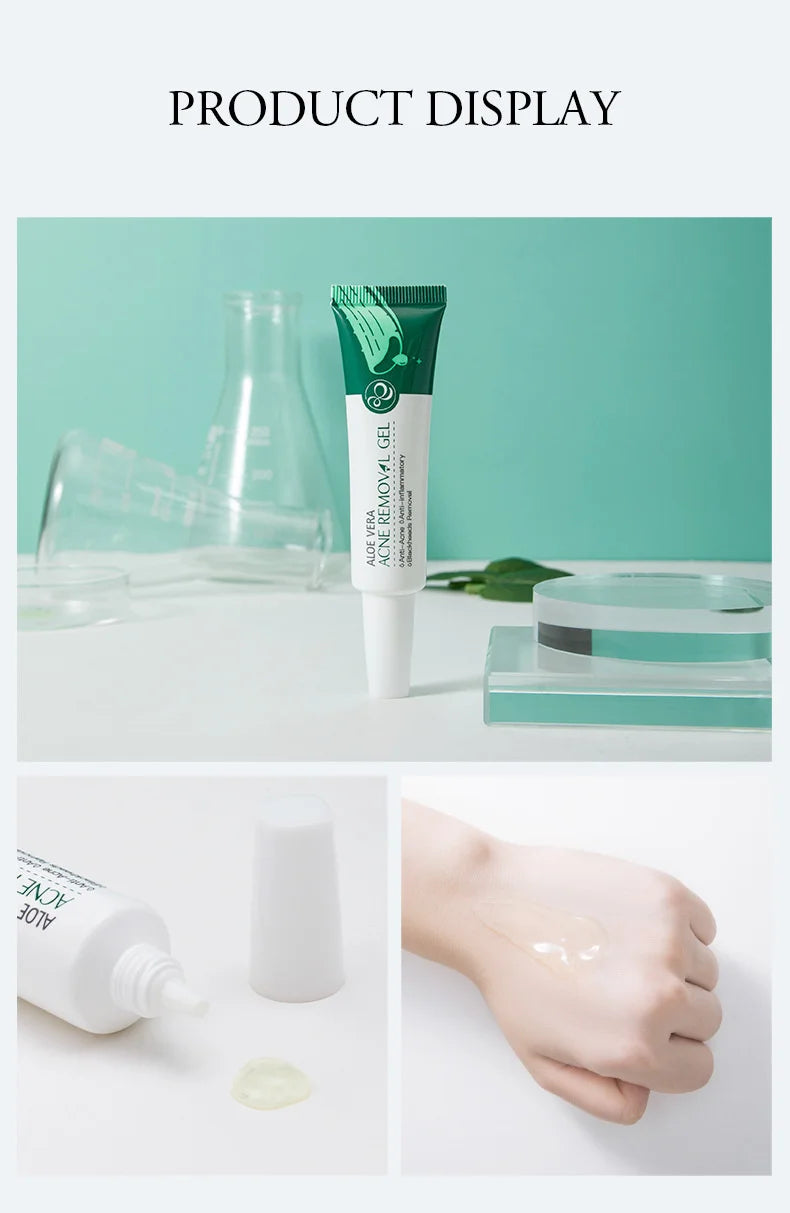 LAIKOU Aloe Vera Gel Soothing Skin Care Remove Acne Moisturizing After Sun Lotions Whitening Moisturizing Acne Treatment Cream