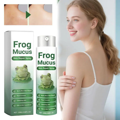 Frog Mucus Skin Repair Spray skin care spray toner pore shrinking acne mark repair for closed acne red skin pore repair skincare
