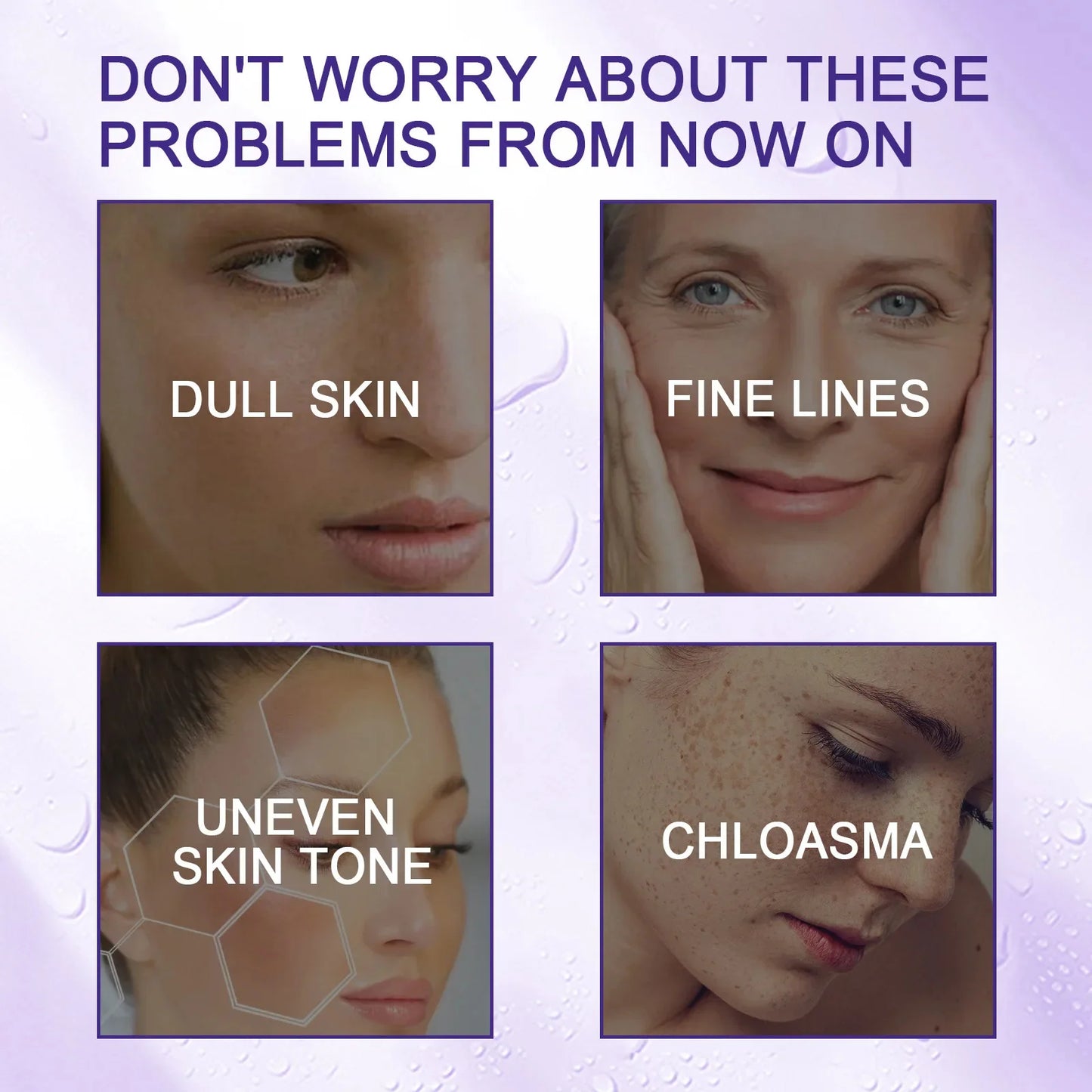 Hoygi Niacinamide Facial Serum Vitamin B3 Wrinkles Pigment Dark Spot Removal Correcting Glow Serum Face Whitening Moisturizer