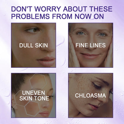 Hoygi Niacinamide Facial Serum Vitamin B3 Wrinkles Pigment Dark Spot Removal Correcting Glow Serum Face Whitening Moisturizer