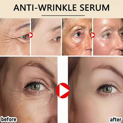 Seoul 1988 2% Retinal Anti Aging Wrinkle Serum Ginseng Facial Essence Firming Pores Brightening Face Moisturizer Korean Skincare