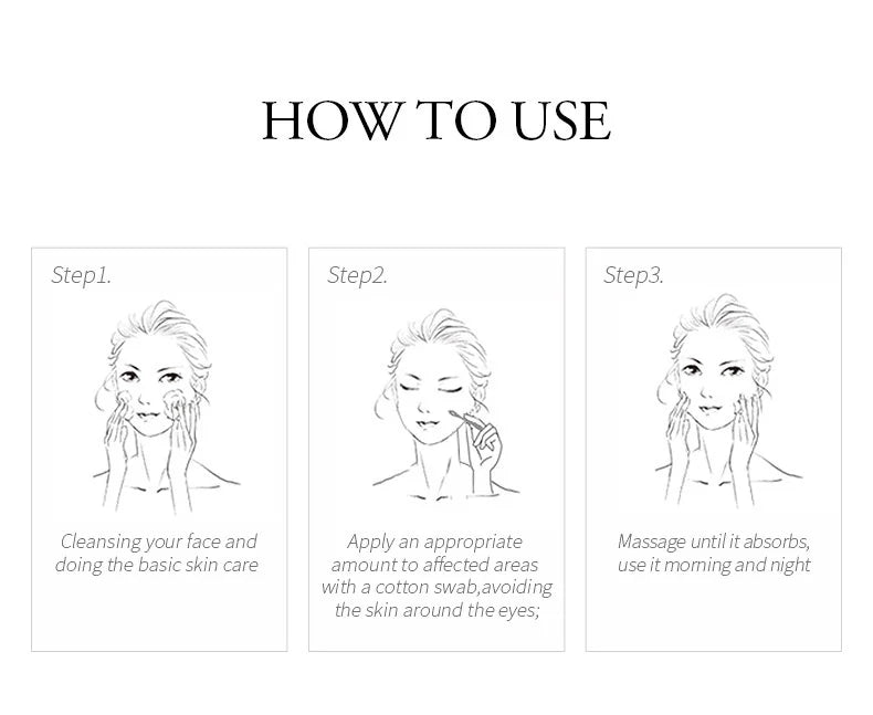 LAIKOU Aloe Vera Gel Soothing Skin Care Remove Acne Moisturizing After Sun Lotions Whitening Moisturizing Acne Treatment Cream