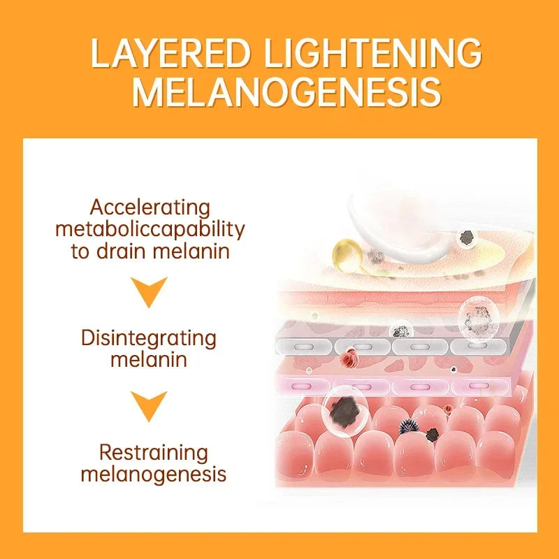 Vitamin C Whitening Freckles Cream Remove Dark Spots Melasma Niacinamide Lighten Melanin Anti-aging Brighten Skin Care Products