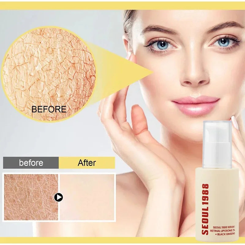Korean 1988 Retinol Face Care Serum,Black Ginseng Niacinamide Vitamin C Moisturizing Firming Ampoule,Anti Aging Wrinkle Skincare