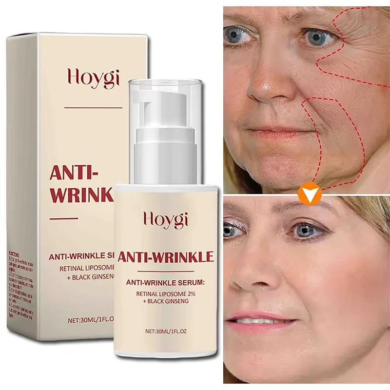 Seoul 1988 2% Retinal Anti Aging Wrinkle Serum Ginseng Facial Essence Firming Pores Brightening Face Moisturizer Korean Skincare