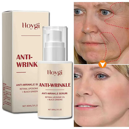 Seoul 1988 2% Retinal Anti Aging Wrinkle Serum Ginseng Facial Essence Firming Pores Brightening Face Moisturizer Korean Skincare