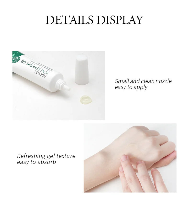 LAIKOU Aloe Vera Gel Soothing Skin Care Remove Acne Moisturizing After Sun Lotions Whitening Moisturizing Acne Treatment Cream