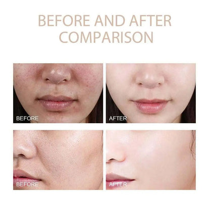 Korean Dr. Melaxin Peel Shot White And Black Rice Exfoliating Essence Brightening Skin Deep Moisturizing Cream Skin Care