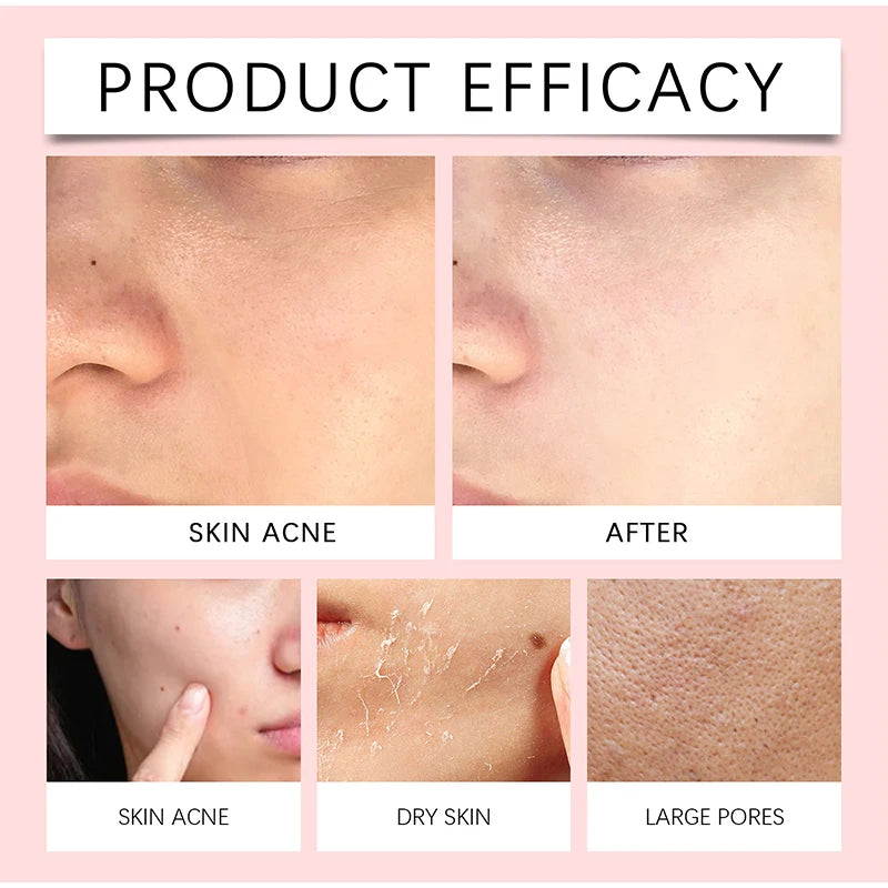 1/2/3/5 Pcs Centella Pore Minimizing Deep Cleansing Foam,Facial Skin Cleanser Moisturizing Soothing,Remove Pore-Clogging Debris