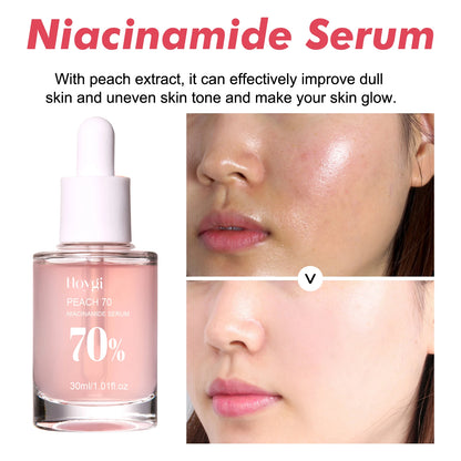 Niacinamide Facial Serum Improves Skin tone,Fades Dark Spots and Acne Improves Enlarged Pores Natural Anti-Aging Face Essence