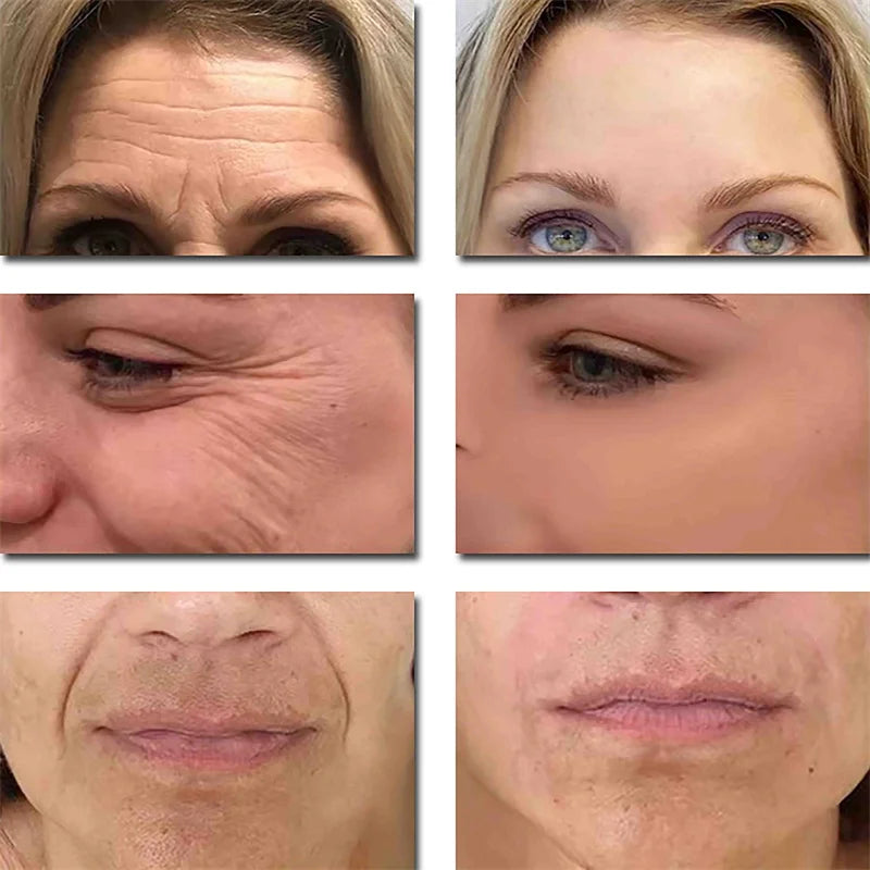 Seoul 1988 2% Retinal Anti Aging Wrinkle Serum Ginseng Facial Essence Firming Pores Brightening Face Moisturizer Korean Skincare