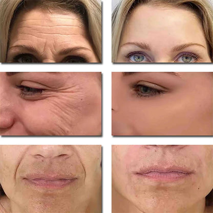 Seoul 1988 2% Retinal Anti Aging Wrinkle Serum Ginseng Facial Essence Firming Pores Brightening Face Moisturizer Korean Skincare