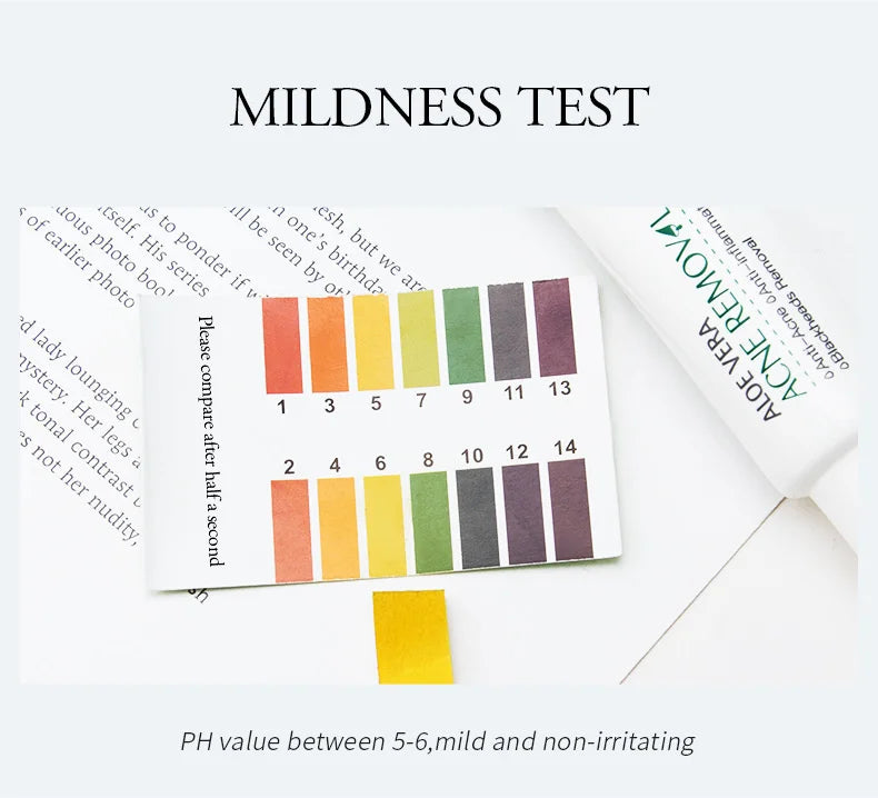 LAIKOU Aloe Vera Gel Soothing Skin Care Remove Acne Moisturizing After Sun Lotions Whitening Moisturizing Acne Treatment Cream