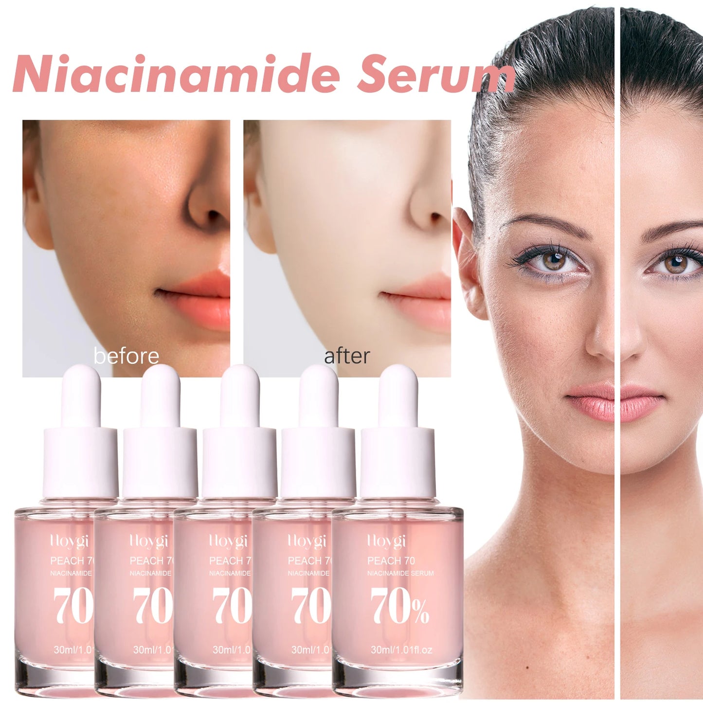 Niacinamide Facial Serum Improves Skin tone,Fades Dark Spots and Acne Improves Enlarged Pores Natural Anti-Aging Face Essence